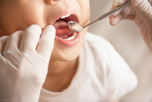 子どもの年齢別歯科治療